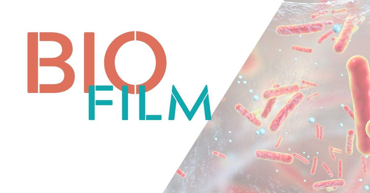 Biofilm - bakterie Legionella